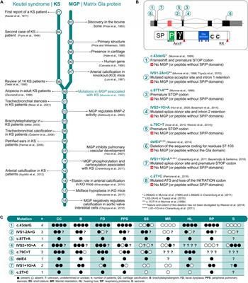 Keutel Syndrome, a Review of 50 Years of Literature